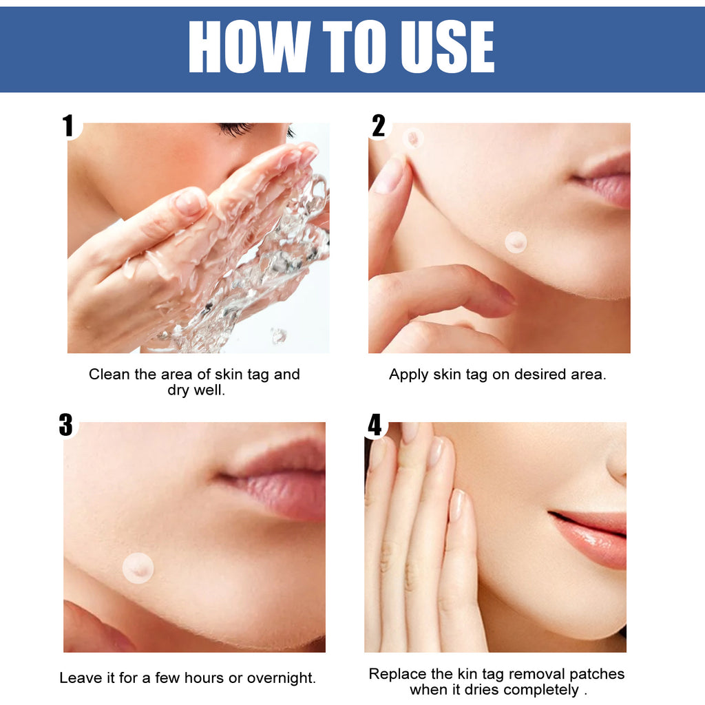 EELHOE Gram Wart Corns Patch, Skin Gram Wart Flesh Mole Black Mole Clean And Care Patch